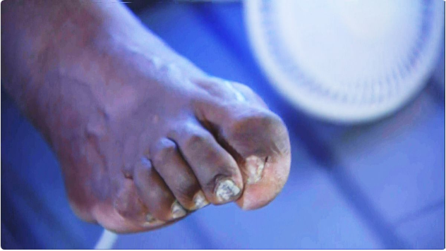 Dedos do pé de Shaquille O´Neal
