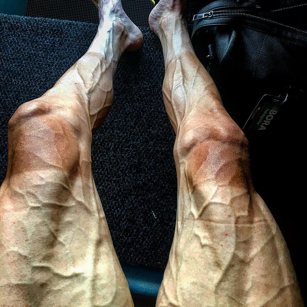 Pernas do ciclista Poljanski após o Tour de France