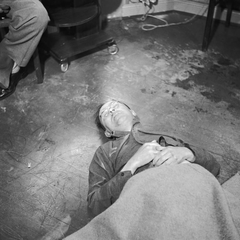 E aqui, o corpo do mesmo Himmler após cometer suicídio por envenenamento de cianureto, em 1945