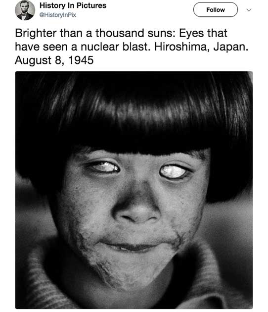 Esta jovem sobreviveu ao ataque de Hiroshima, no Japão, em 1945. No entanto, os efeitos da bomba atômica a deixou completamente cega