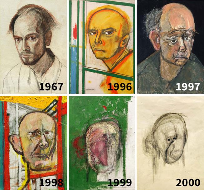 William Utermohlen foi diagnosticado com Alzheimer. Ele começou a fazer seu autorretrato até não conseguir mais reconhecer seu próprio rosto