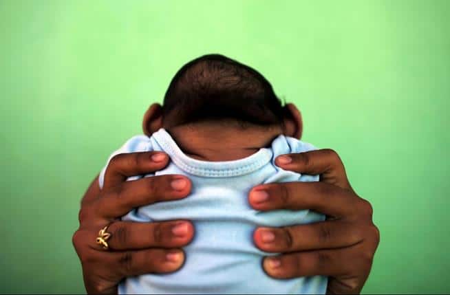 Jaqueline, de 26 anos, segura o filho, com quatro meses, que nasceu com microcefalia em decorrência do zika vírus. Olinda, 11 de fevereiro de 2016