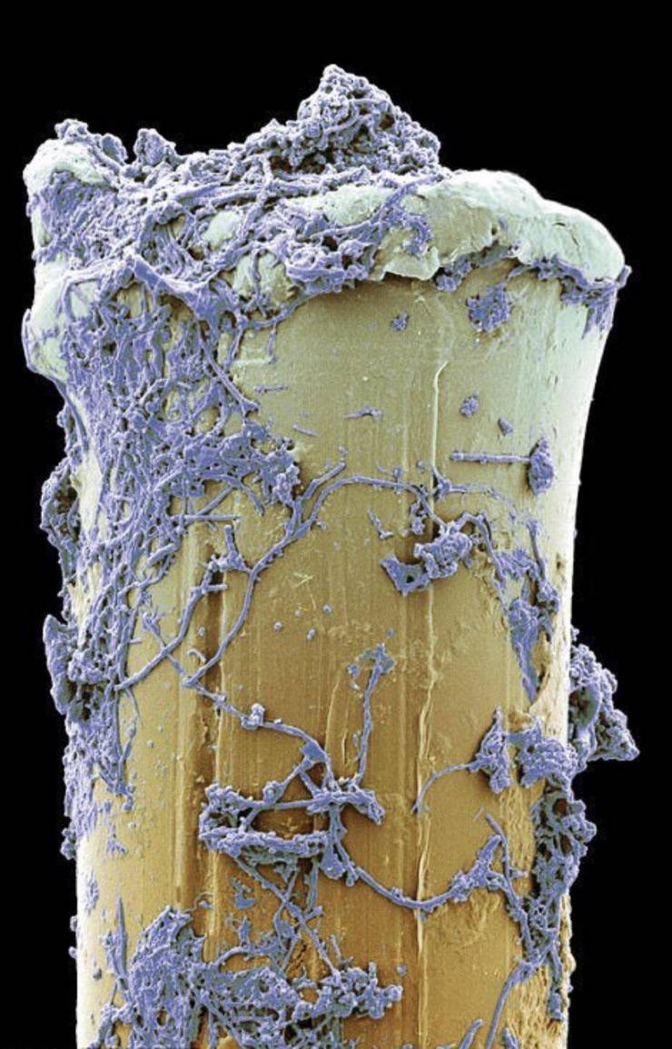 Esta é uma única cerda de uma escova de dentes após o uso vista através do microscópio