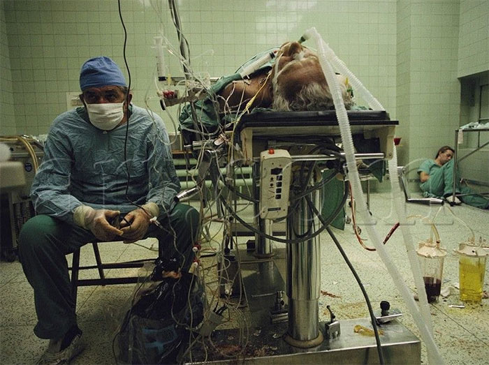Foto de 1987. Nela, um médico descansa após realizar um transplante cardíaco que durou 23 horas. No canto inferior direito, você pode ver um de seus colegas igualmente exausto.