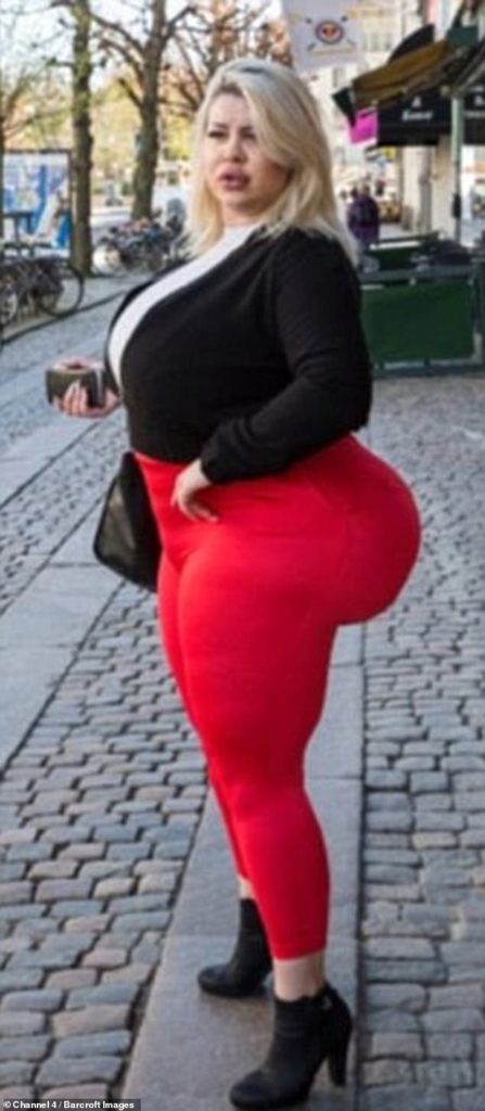 Mulher Que Busca Ter Maior Bumbum Do Mundo Diz Que Os Homens T M Medo