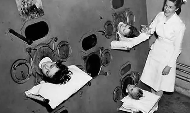 Antes da criação da vacina contra poliomelite, muitas crianças viveram por meses nessas máquinas, que serviam como uma espécie de pulmão de aço - 1937.