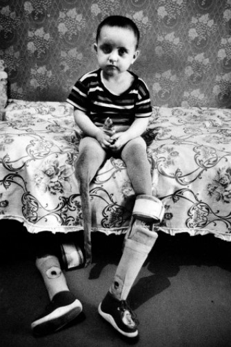 Markha, uma menina cujas pernas foram arrancadas em um ataque russo. A explosão matou sua mãe, que estava protegendo-a. Primeira Guerra chechena, 1995.