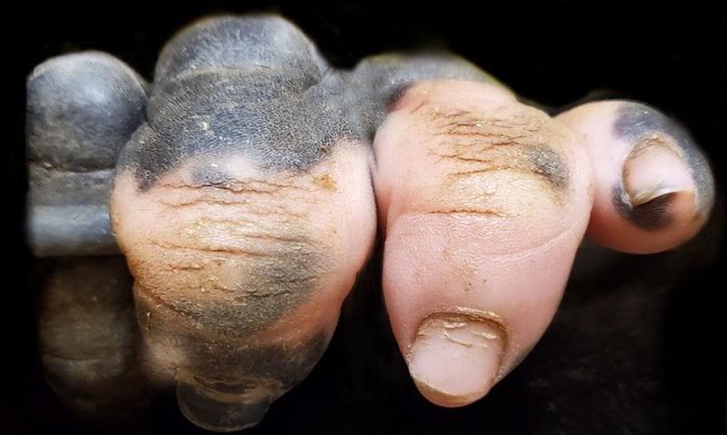 Dedos de um gorila com vitiligo.