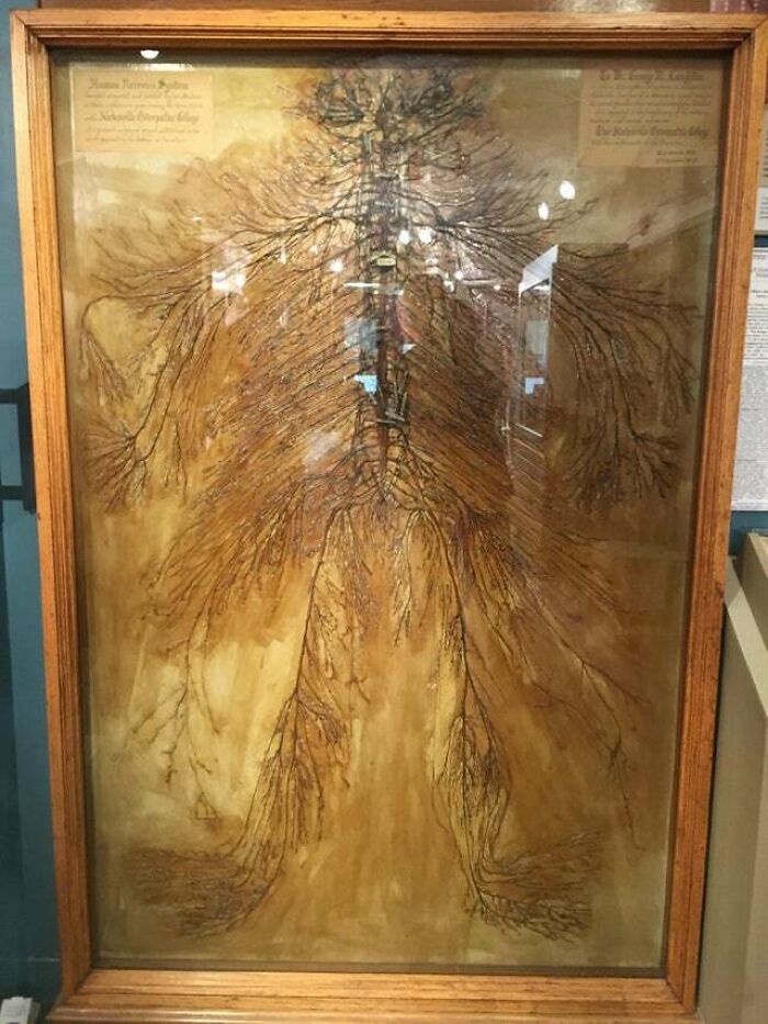 Este é um sistema nervoso humano intacto que foi dissecado por dois estudantes de medicina em 1925. Demorou mais de 1500 horas. Existem apenas 4 desses no mundo.