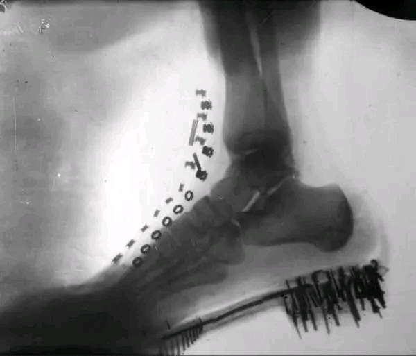 Raio-x do pé de Nikola Tesla feito por ele mesmo usando uma máquina que ele projetou em 1896.