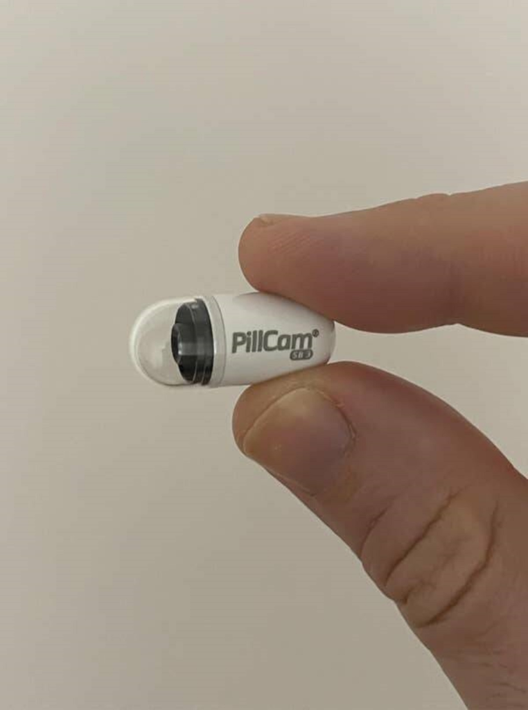Esta é uma pequena câmera do tamanho de um comprimido que você engole para que os médicos possam ter uma... bem, uma visão muito íntima do seu sistema digestivo